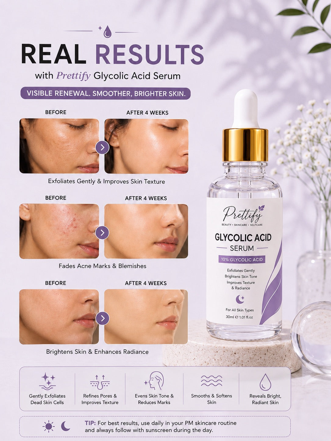 Prettify 10% Glycolic Acid Resurfacing Serum for smoother and radiant-looking skin